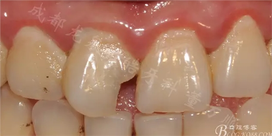 QQ圖片20150710095707.png QQ圖片20150710095707.png