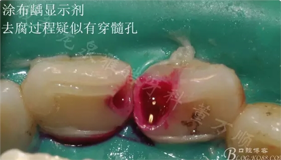 QQ圖片20150710101141.png QQ圖片20150710101141.png