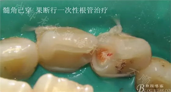 QQ圖片20150710101358.png QQ圖片20150710101358.png