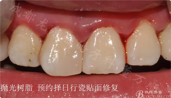 QQ圖片20150710102324.png QQ圖片20150710102324.png