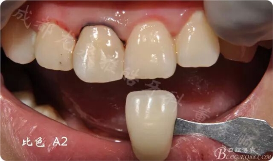 QQ圖片20150710103111.jpg QQ圖片20150710103111.jpg