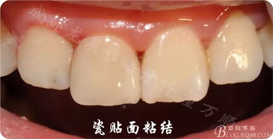 QQ圖片20150710103926.jpg QQ圖片20150710103926.jpg