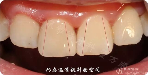 QQ圖片20150710103932.jpg QQ圖片20150710103932.jpg