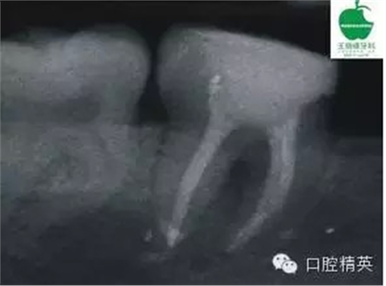 QQ圖片20150710104027.png QQ圖片20150710104027.png