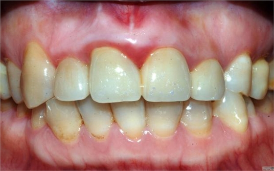 認(rèn)真看待根管治療在醫(yī)院診所技術(shù)中的地位 認(rèn)真看待根管治療在醫(yī)院診所技術(shù)中的地位