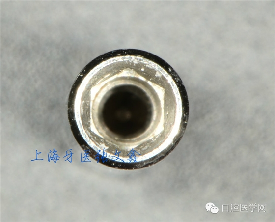 種植替代體上的細(xì)節(jié)不可忽視 種植替代體上的細(xì)節(jié)不可忽視