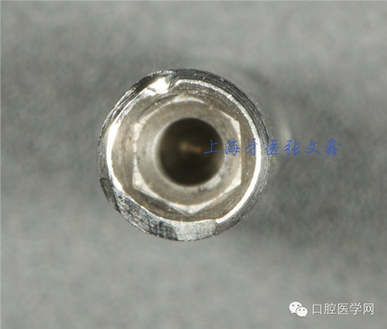 種植替代體上的細(xì)節(jié)不可忽視 種植替代體上的細(xì)節(jié)不可忽視