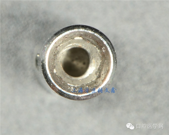 種植替代體上的細(xì)節(jié)不可忽視 種植替代體上的細(xì)節(jié)不可忽視