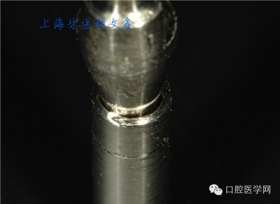 種植替代體上的細(xì)節(jié)不可忽視 種植替代體上的細(xì)節(jié)不可忽視