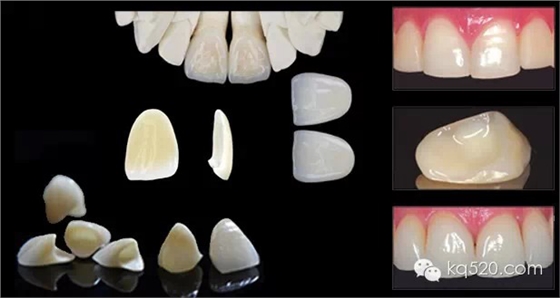 QQ圖片20150711173700.png QQ圖片20150711173700.png