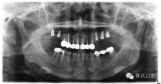 QQ圖片20150711174937.png QQ圖片20150711174937.png