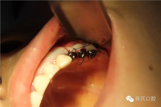 QQ圖片20150711175330.jpg QQ圖片20150711175330.jpg