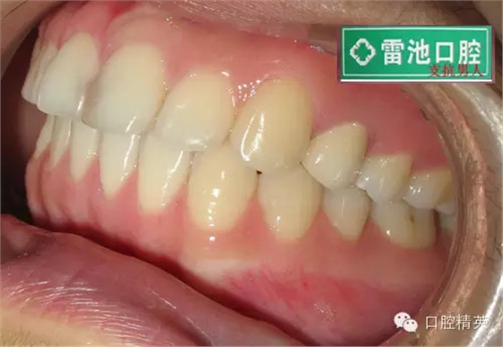 QQ圖片20150712091643.png QQ圖片20150712091643.png