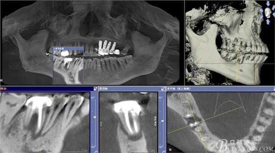 QQ圖片20150712103334.png QQ圖片20150712103334.png