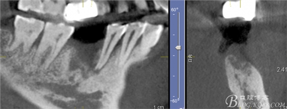 QQ圖片20150712103833.png QQ圖片20150712103833.png