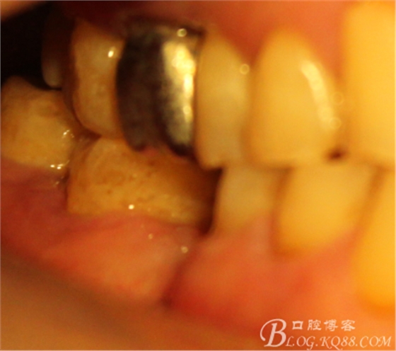 QQ圖片20150712103914.png QQ圖片20150712103914.png