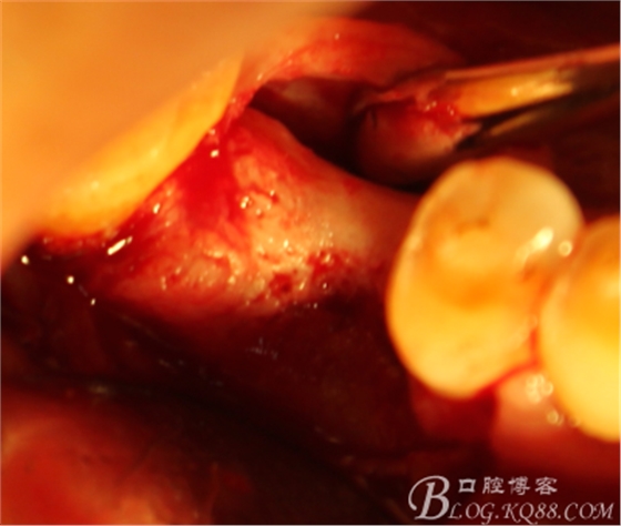 QQ圖片20150712103943.png QQ圖片20150712103943.png