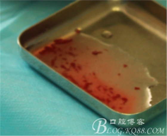 QQ圖片20150712104053.png QQ圖片20150712104053.png