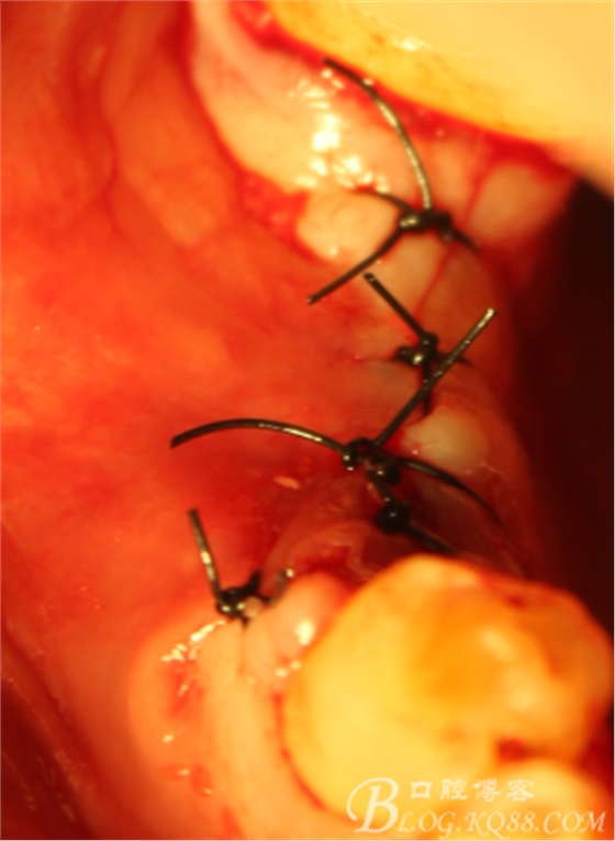 QQ圖片20150712104333.png QQ圖片20150712104333.png