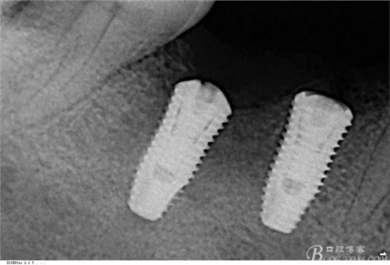 QQ圖片20150712104437.png QQ圖片20150712104437.png