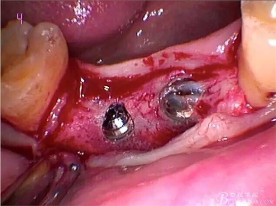 QQ圖片20150712104535.jpg QQ圖片20150712104535.jpg