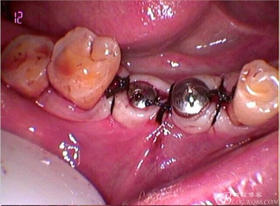 QQ圖片20150712104714.jpg QQ圖片20150712104714.jpg