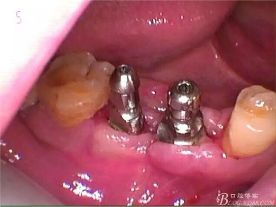 QQ圖片20150712104747.jpg QQ圖片20150712104747.jpg