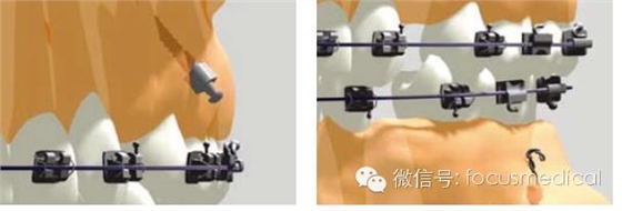 QQ圖片20150712111508.png QQ圖片20150712111508.png