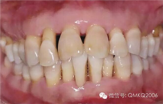 QQ圖片20150712115716.jpg QQ圖片20150712115716.jpg