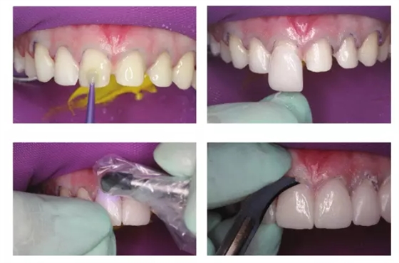 QQ圖片20150714152541.png QQ圖片20150714152541.png