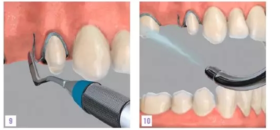 QQ圖片20150716172812.png QQ圖片20150716172812.png