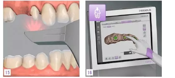 QQ圖片20150716172856.png QQ圖片20150716172856.png