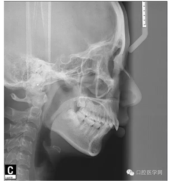 QQ圖片20150717171157.png QQ圖片20150717171157.png