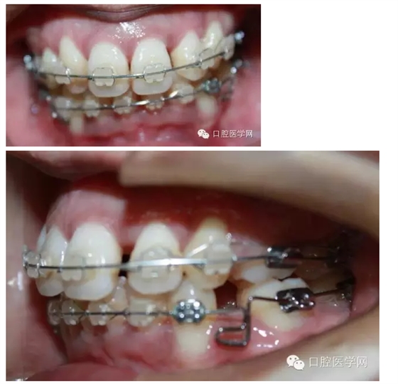 QQ圖片20150717171229.png QQ圖片20150717171229.png