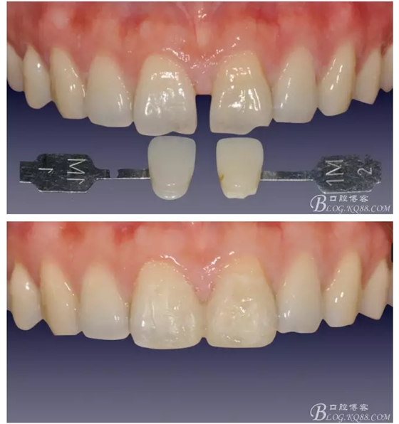 QQ圖片20150718114237.png QQ圖片20150718114237.png