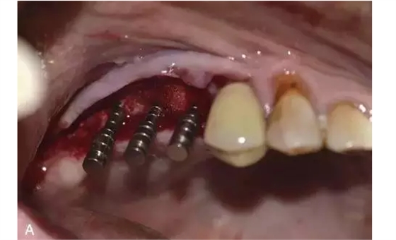 QQ圖片20150718145319.png QQ圖片20150718145319.png