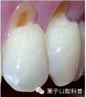 QQ圖片20150718181012.png QQ圖片20150718181012.png