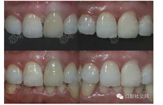 QQ圖片20150720144441.png QQ圖片20150720144441.png