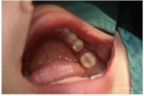 QQ圖片20150721091316.png QQ圖片20150721091316.png