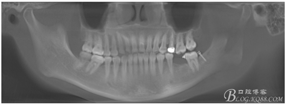 QQ圖片20150721091650.png QQ圖片20150721091650.png