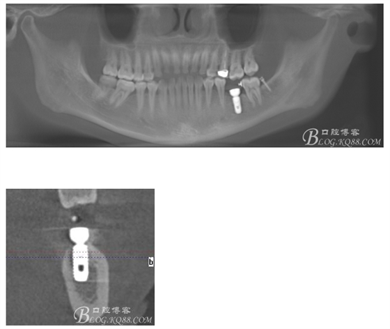 QQ圖片20150721091740.png QQ圖片20150721091740.png