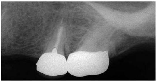 QQ圖片20150721093504.png QQ圖片20150721093504.png