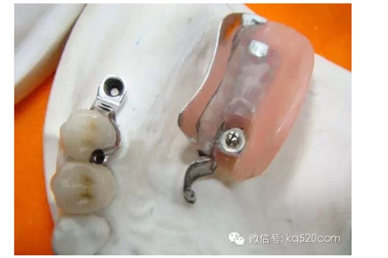 QQ圖片20150721105632.png QQ圖片20150721105632.png