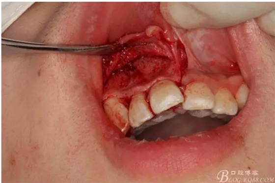 QQ圖片20150721155001.png QQ圖片20150721155001.png