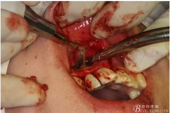 QQ圖片20150721155106.png QQ圖片20150721155106.png