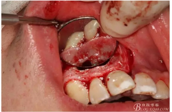 QQ圖片20150721155121.png QQ圖片20150721155121.png