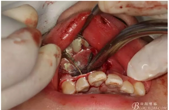 QQ圖片20150721155136.png QQ圖片20150721155136.png