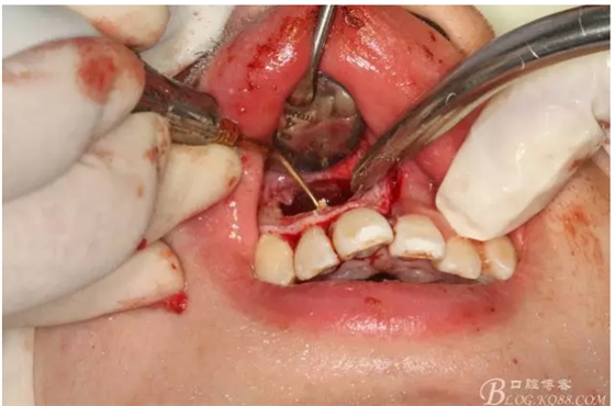 QQ圖片20150721155204.png QQ圖片20150721155204.png