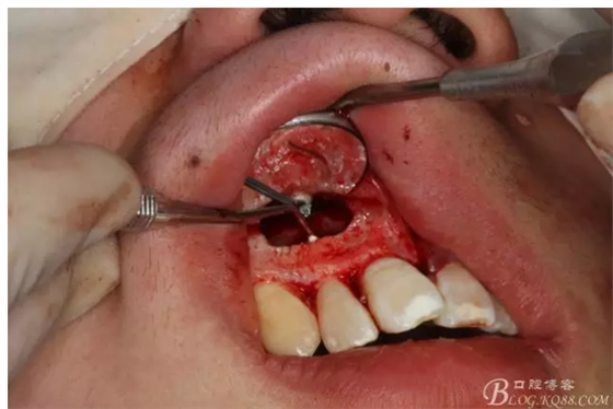 QQ圖片20150721155218.png QQ圖片20150721155218.png