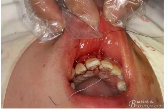 QQ圖片20150721155307.png QQ圖片20150721155307.png